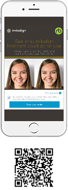 Invisalign SmileView on a mobile device